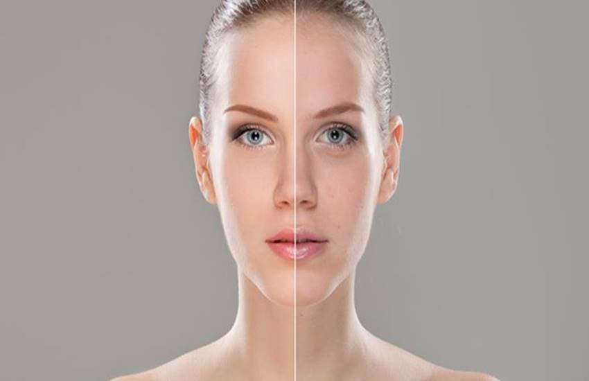 Skin, Skin summers, how to take care of skin, skin problems, hair tips, tips for skin and hairs, health tips, health tips in hindi