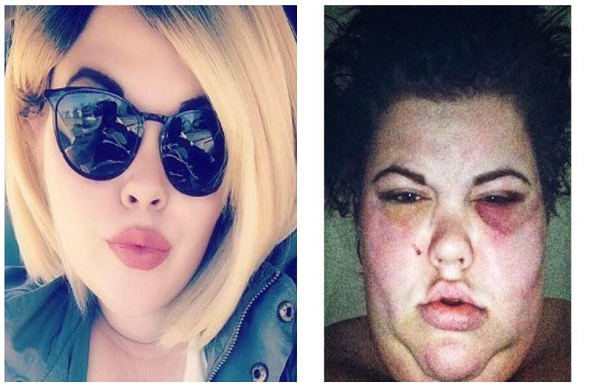 US man, us,beats girlfriends, Prosecutors, Disease Control and Prevention (CDC), डेलावेयर, mental health,कार्टर, डेलावेयर कोर्ट US man, us,beats girlfriends, Prosecutors, Disease Control and Prevention (CDC), डेलावेयर, mental health,कार्टर, डेलावेयर कोर्ट