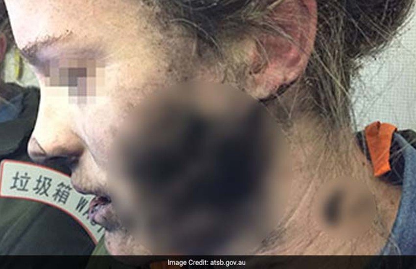 लड़की का नाम फिलहाल नहीं बताया गया है।