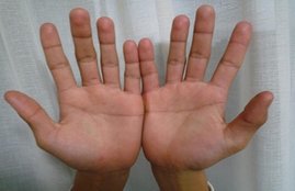 hands line, crorepti, hand, luck, mind, fingure, मस्तिष्क रेखा, आर्थिक स्थिति, अंग्रेजी, उंगलियां सीधी और पतली