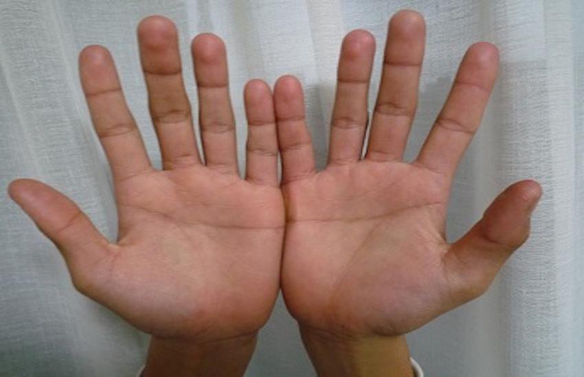 hands line, crorepti, hand, luck, mind, fingure, मस्तिष्क रेखा, आर्थिक स्थिति, अंग्रेजी, उंगलियां सीधी और पतली