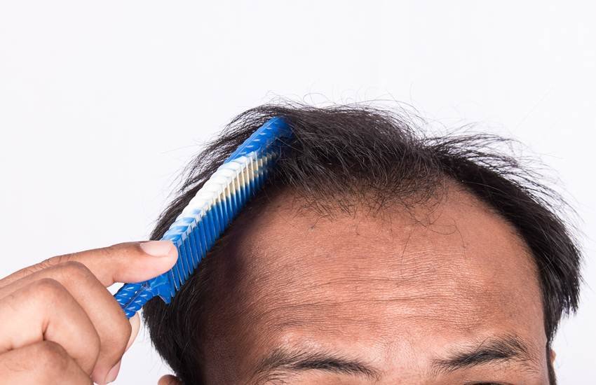 Hair Fall, hair fall solution in hindi, hair fall solution, hair fall control remedies in hindi, hair fall control remedies, how to prevent hair fall, how to prevent hair fall in hindi, how to prevent hair fall in men, how to prevent hair fall in women, how to prevent hair fall naturally, hair tips, beauty tips in hindi, lifestyle news in hindi, health news in hindi, jansatta