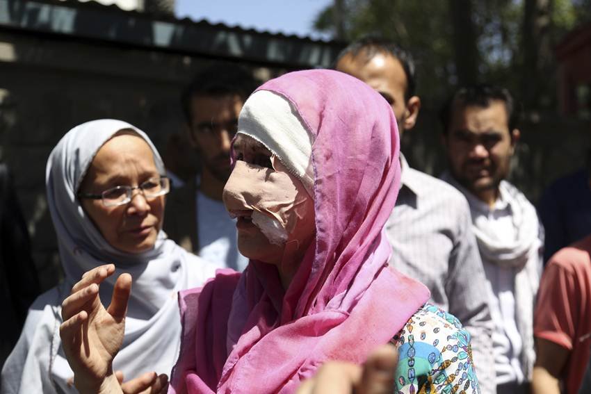 , indian embassy, kabul bomb blast, afganistan news in hindi, kabul news in hindi, kabul bomb blast 2017, kabul latest bomb blast, jansatta, india