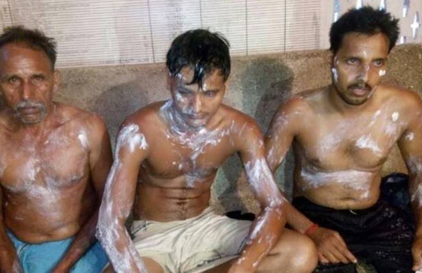 तेजाब से झुलसे तीनों पीड़ितों को भागलपुर जेएनएल मेडिकल कालेज अस्पताल रेफर कर दिया गया है। (Express Photo)