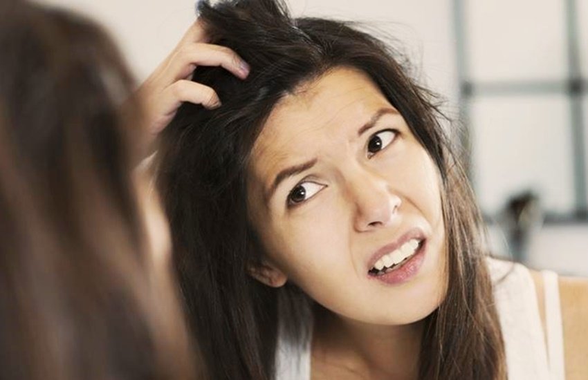 dandruff, remove dandruff, remove dandruff with these natural ways, remove dandruff tips, get rid from dandruff with these ways, hair care tips, hair dandruff remove tips, hair care tips in hindi, hair care dandruff tips in hindi, remove dandruff tips in hindi, remove dandruff with these natural ways in hindi, skin tips, skin tips in hindi, lifestyle news in hindi, lifestyle news, jansatta dandruff, remove dandruff, remove dandruff with these natural ways, remove dandruff tips, get rid from dandruff with these ways, hair care tips, hair dandruff remove tips, hair care tips in hindi, hair care dandruff tips in hindi, remove dandruff tips in hindi, remove dandruff with these natural ways in hindi, skin tips, skin tips in hindi, lifestyle news in hindi, lifestyle news, jansatta