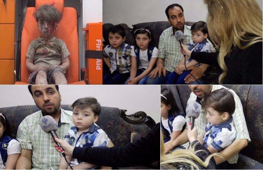 सीरिया के 5 वर्षीय ओमरान दकनीश को तो आप जानते ही होंगे जो कि सीरिया के कई इलाकों में चल रहे खूनी संघर्ष का गवाह बन चुका है।