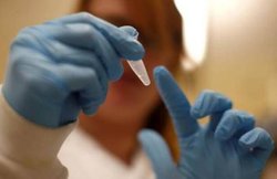 अगर आपको भी है पित्त की थैली में पथरी तो अपने डाइट चार्ट से हटा दें ये चीजें