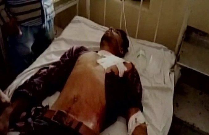 एमपी: हिंसक प्रदर्शन में 5 किसानों की मौत, शिवराज सिंह चौहान और सपा ने किया मुआवजे का ऐलान