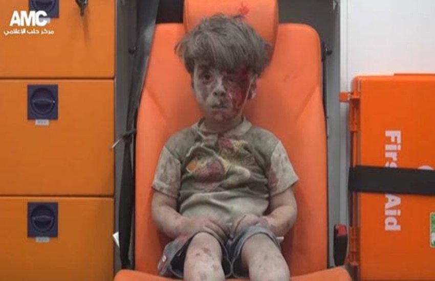 ओमरान अलेप्पों के नजदीक हुए एक हवाई हमले के बाद बुरी तरह से घायल हो गया था। ओमरान की खून से लतपत एक तस्पीर पूरे देश के मीडिया चैनलों की हेडलाइन बनी जिसके बाद कई लोगों ने ओमरान के सही सलामत रहने की दुआ मांगी थी।