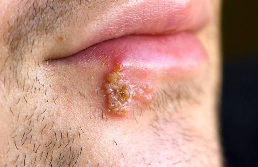 तस्वीर का इस्तेमाल प्रतीक के तौर पर किया गया है।  तस्वीर का इस्तेमाल प्रतीक के तौर पर किया गया है।