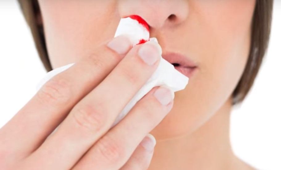 Nose Bleeding, Reason Of Nose Bleeding, Treatment For The Nose Bleeding, Nakseer Footna, Cynus Infection, Health Tips, Nose Health Tips, Tumor, Blood Pressure, Blood Cancer, Lifestyle News In Hindi, Jansatta