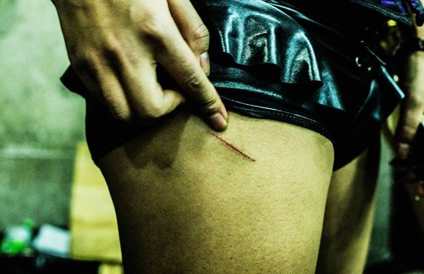 लोगों के मनोरंजन में इन्हें चोटें भी लगती रहती हैं।