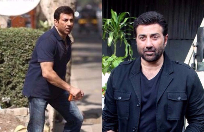 सनी देयोल ने भी हेयर ट्रांसप्लांट करवाया है।