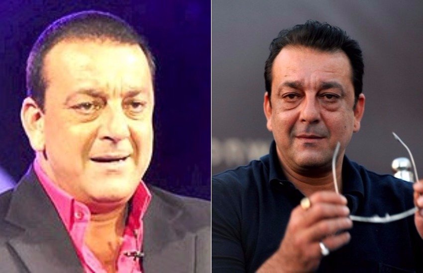 संजय दत्त बिना बालों के ऐसे नजर आते थे, फिर वक्त रहते उन्होंने हेयर ट्रांसप्लांट का सहारा लिया।