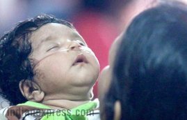 gorakhpur brd medical college, child death