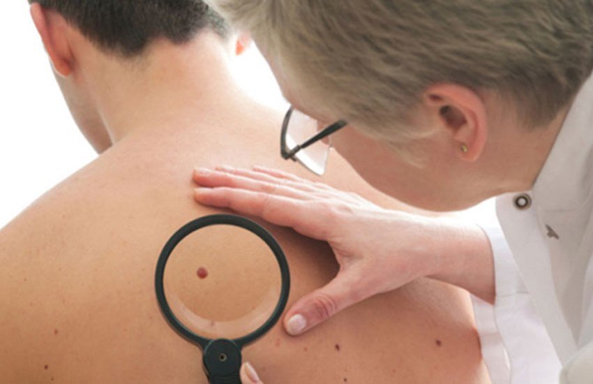 कैंसर जैसी गंभीर समस्या का शिकार देशभर में कई लोग बन जाते हैं और कई बार उन्हें इसका पता भी नहीं लगता। (File Photo) कैंसर जैसी गंभीर समस्या का शिकार देशभर में कई लोग बन जाते हैं और कई बार उन्हें इसका पता भी नहीं लगता। (File Photo)