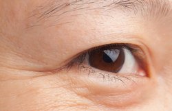 चेहरे से झुर्रियों को गायब कर सकता है चावल का पानी, ऐसे करें इस्तेमाल