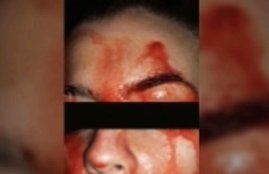 Italian Woman Sweats Blood