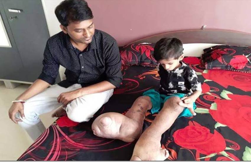 पिछले छह साल से एक लाइलाज बीमारी से ग्रसित है यह बच्चा (ians)