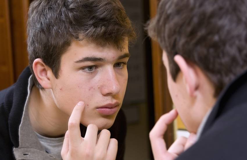 skin tips for men, skin tips for men in hindi, how to get rid of pimples in hindi, pimples on face, home remedies for men skin care, home remedies for pimples in men, skin care tips, skin care tips in hindi, beauty tips, beauty tips in hindi, lifestyle news in hindi, jansatta skin tips for men, skin tips for men in hindi, how to get rid of pimples in hindi, pimples on face, home remedies for men skin care, home remedies for pimples in men, skin care tips, skin care tips in hindi, beauty tips, beauty tips in hindi, lifestyle news in hindi, jansatta