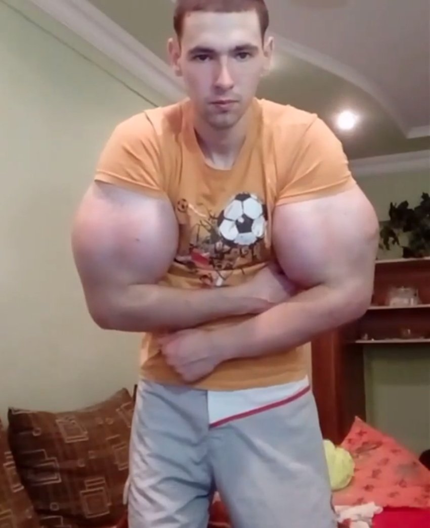 Kirill Tereshin, Weird Body, Bodybuilding, Bodybuilding Side Effects, Whey Protein Side Effects, Nutritional Body Side Effects, Kirill Tereshin Instagram, Kirill Tereshin Photos, Bodybuilding Experiments, Build Body in 10 Days