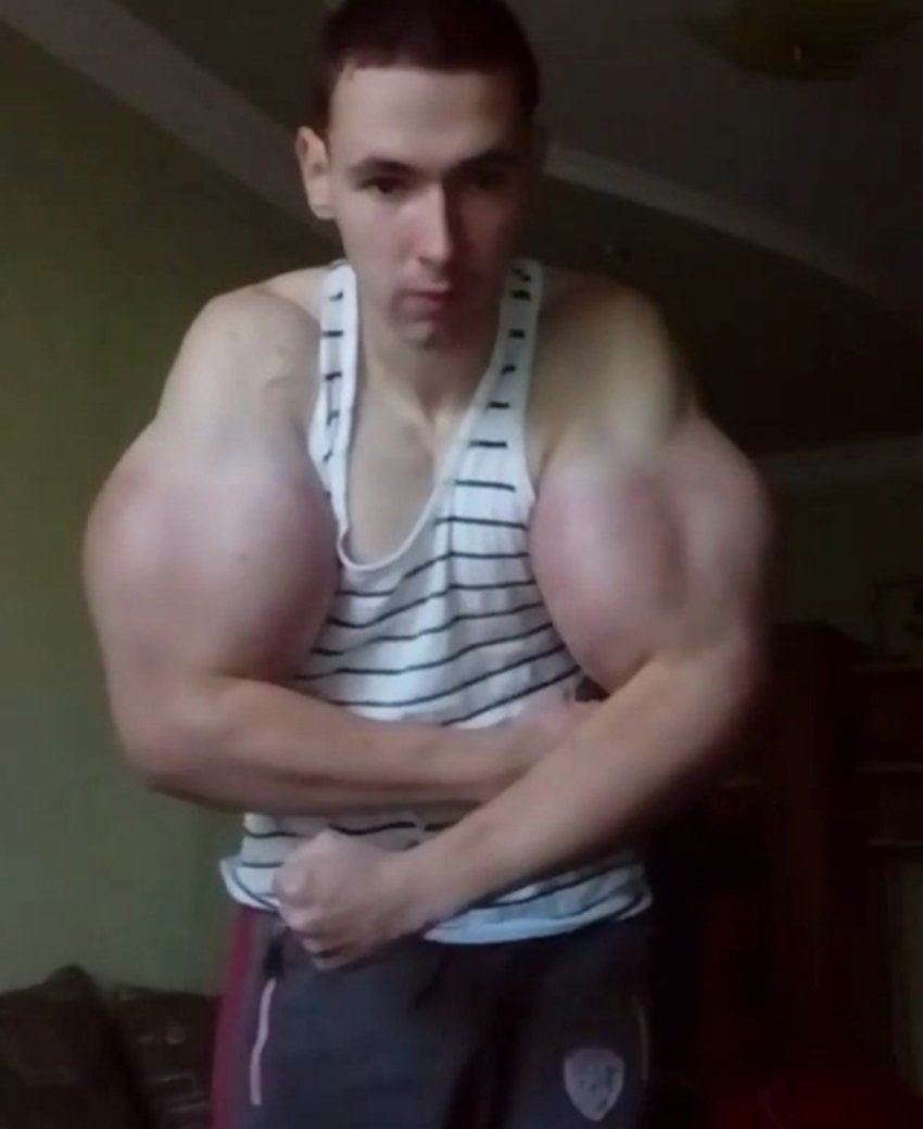 Kirill Tereshin, Weird Body, Bodybuilding, Bodybuilding Side Effects, Whey Protein Side Effects, Nutritional Body Side Effects, Kirill Tereshin Instagram, Kirill Tereshin Photos, Bodybuilding Experiments, Build Body in 10 Days