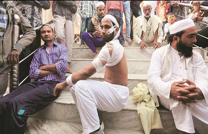 मेडिकल रिपोर्ट्स के अनुसार इसरार को कमर, हाथों और सिर में गंभीर चोट आई है। (Express Photo/Prem Nath Pandey)