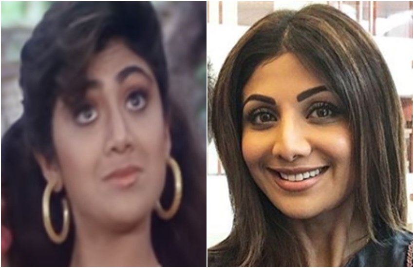 Bollywood actress, Koena Mitra, Ayesha Takia, Anushka Sharma, minissha Lamba, Shilpa Shetty, Sridevi, Vaani Kapoor, Plastic Surgery, Bollywood Celebs, Bollywood Celebs Before and After Plastic Surgery, Entertainment, jansatta