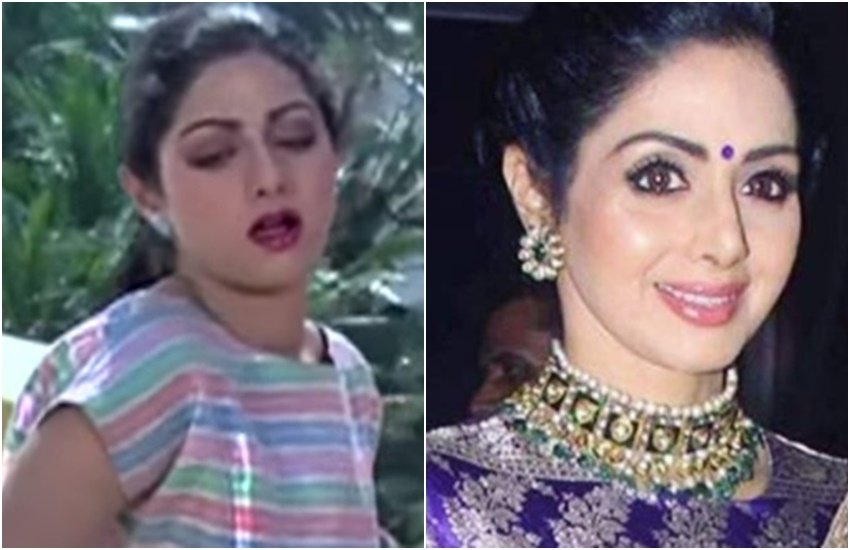 Bollywood actress, Koena Mitra, Ayesha Takia, Anushka Sharma, minissha Lamba, Shilpa Shetty, Sridevi, Vaani Kapoor, Plastic Surgery, Bollywood Celebs, Bollywood Celebs Before and After Plastic Surgery, Entertainment, jansatta