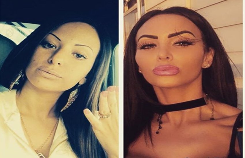 डालगुडीज का कहना है कि जब वो जवान थी तब उनके पिता ने उन्हें बदसूरत कहा था तभी उन्होंने ठान ली थी कि वो अपने लुक बदलकर रहेंगी।