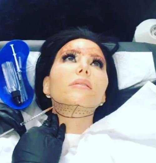 डालगुडीज अब तक करीब 200 सर्जरी करा चुकी हैं। अपने सर्जरी के छोटे छोटे वीडियो भी इंस्टाग्राम पर पोस्ट करती हैं। हाल ही में उनके जबड़े की सर्जरी हुई है।