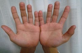 hast rekha, hand lines, read hand lines, hast rekha vigyan, heart line, mind line, life line, hand lines cut each other, religious news, latest news about hand reading, palm reading, palm reading in hindi, jansatta