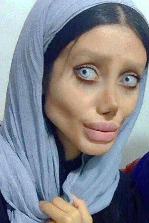 हालांकि कई लोगों की राय है कि ये उनका मेकअप है। क्योंकि कई पिक्चर्स ने उनकी नाक और गाल बेहद अलग नजर आ रहे हैं।