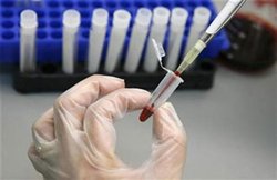 मध्‍य प्रदेश: सिपाही से बोला- मुझे एड्स है, फिर दांत काटकर भागने लगा बदमाश