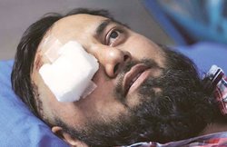 कासगंज में घायल अकरम ने कहा- मैंने सबको किया माफ, मैं तो अपनी पत्नी से मिलने गया था, 100-150 लोगों ने बोल दिया हमला