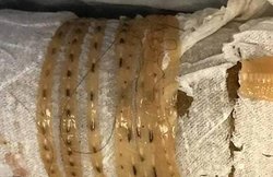 पूर्व मॉडल की दर्दनाक मौत, नर्सिंग होम में जिंदा खा गए कीड़े!