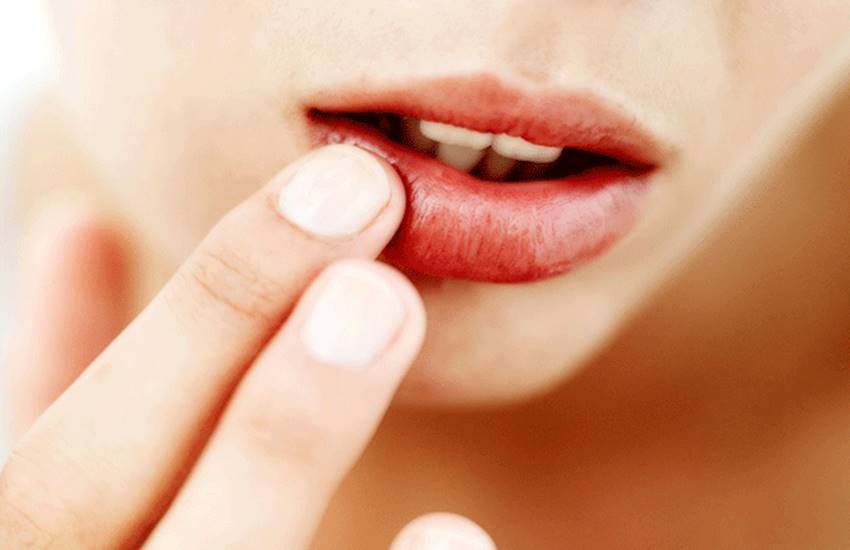 lip pimples, lip pimples in hindi, lip pimples causes in hindi, lip pimples treatment in hindi, upper lip pimples treatment in hindi, home remedies for lip pimples in hindi, home remedies for upper lip pimple in hindi, lip pimples removal paste in hindi, lip care in hindi, beauty tips in hindi, skin care tips in hindi, lifestyle news in hindi, jansatta