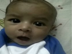 पाकिस्तान के 4 महीने के बच्चे को नोएडा अस्पताल में मिली नई जिंदगी