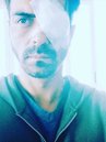Actors Injured During Shoot, Shooting Accidents, Bollywood Accidents, Ranveer Singh, Hritik Roshan, Alia Bhatt, Malaika Arora Khan, John Abraham, Kangana Ranaut