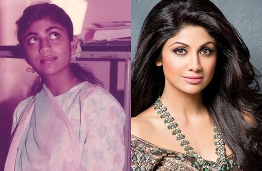 Cosmetic Surgery, Actress Surgery, Surgery Went Wrong, Kangana Ranaut, Minisha Lamba, Anushka Sharma, Sushmita Sen, Gauhar Khan, Shilpa Shetty