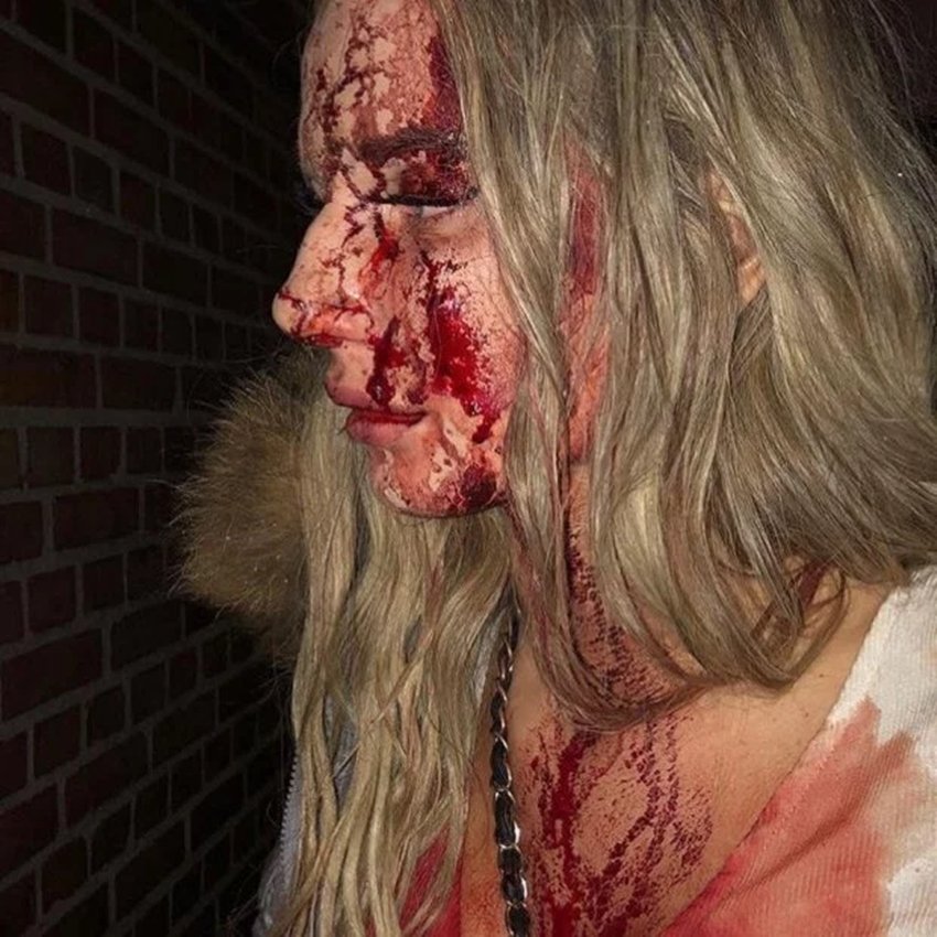 Sophie Johansson, Model, Beer Bottle, Sophie Case, Sophie Club Fight, Weird News, International, Entertainment News