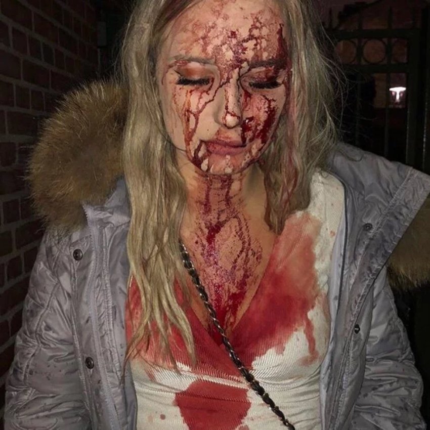 Sophie Johansson, Model, Beer Bottle, Sophie Case, Sophie Club Fight, Weird News, International, Entertainment News
