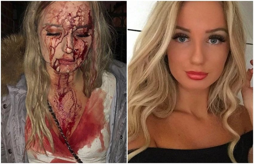 Sophie Johansson, Model, Beer Bottle, Sophie Case, Sophie Club Fight, Weird News, International, Entertainment News