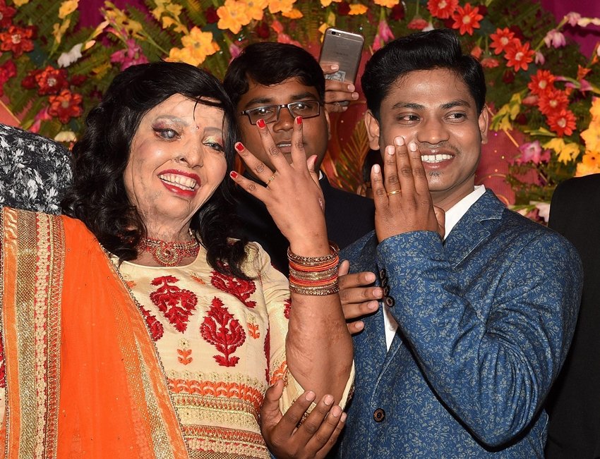 Pramodini aka Rani, a victim of acid attack, got a unique gift on Valentine's Day, Bollywood News, Bollywood News in Hindi, News in Hindi, Entertenment news in Hindi, crime news, naitonal news, international news, trending news, twitter news, Viral story in Hindi, Latest news in Hindi, Jansatta