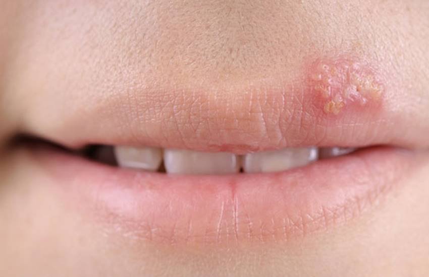 nutrition, right diet plan in hindi, signs indicate wrong diet you are taking, how to know if you lack nutrients in hindi, lack of nutrients in hindi, lack of nutrients symptoms in hindi, health news in hindi, lifestyle news in hindi, jansatta nutrition, right diet plan in hindi, signs indicate wrong diet you are taking, how to know if you lack nutrients in hindi, lack of nutrients in hindi, lack of nutrients symptoms in hindi, health news in hindi, lifestyle news in hindi, jansatta