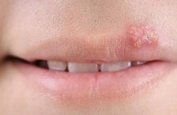 पोषण की कमी की ओर इशारा करते हैं शरीर में दिखने वाले ये 5 सामान्य लक्षण