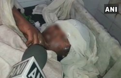 मध्य प्रदेश: रेप का किया विरोध तो नाबालिग दलित लड़की को जला डाला