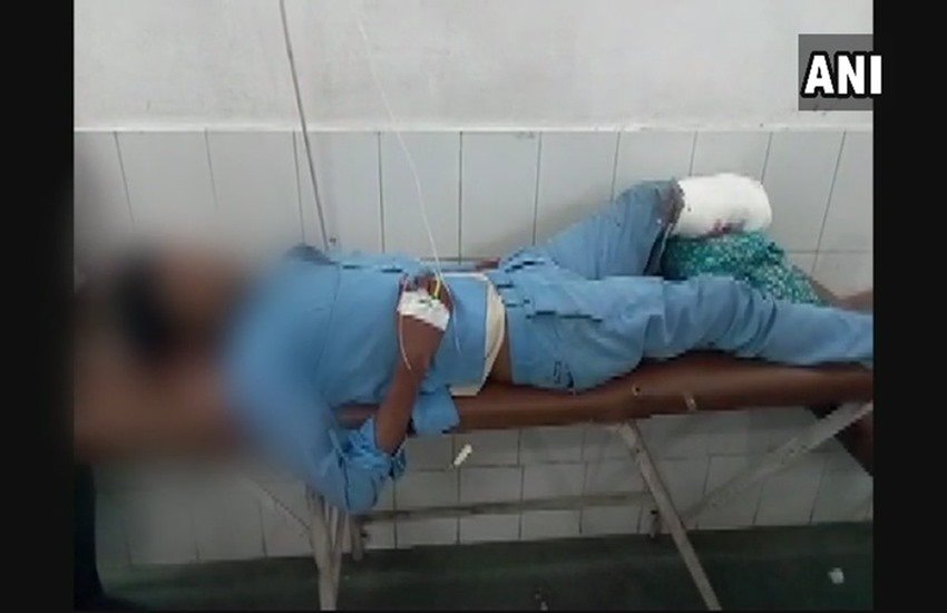 Maharani Laxmi Bai Jhansi Medical College, leg used as pillow, Severed leg used as pillow, severed leg as a pillow, टांग, कटा हुआ टांग, Jhansi Medical College, Uttar Pradesh hospitals, hindi news, medical apathy, Hindi news, News in Hindi, Jansatta