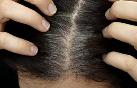 health, fitness, hair, hair care, hair says about fitness, hair says about health, hair says about you, baldness, hair fall, hair related problems, hair style, hair and health in hindi, beauty tips in hindi, lifestyle news in hindi, jansatta