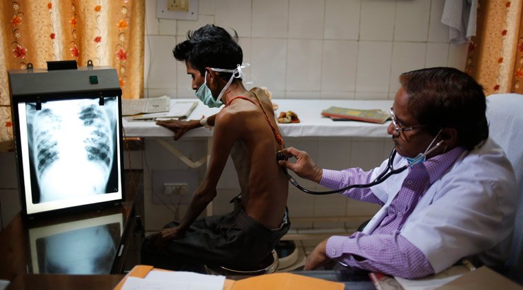 स्वास्थ्य विभाग के ताजा आंकड़े बताते हैं कि दुनिया भर में बीमारियों से मौत के दस शीर्ष कारणों में एक प्रमुख कारण टीबी है। 